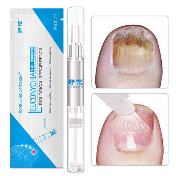 1PC 3ML Fungal Nail Treatment Pen Onychomycosis Paronychia Anti Fungal Nail Infection Chinese Herbal Care Medicinal Liquid TSLM2